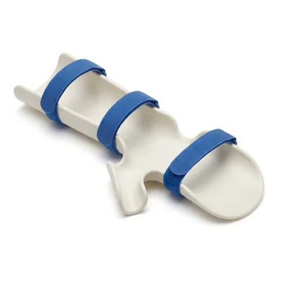 Custom-made splints: example product photo